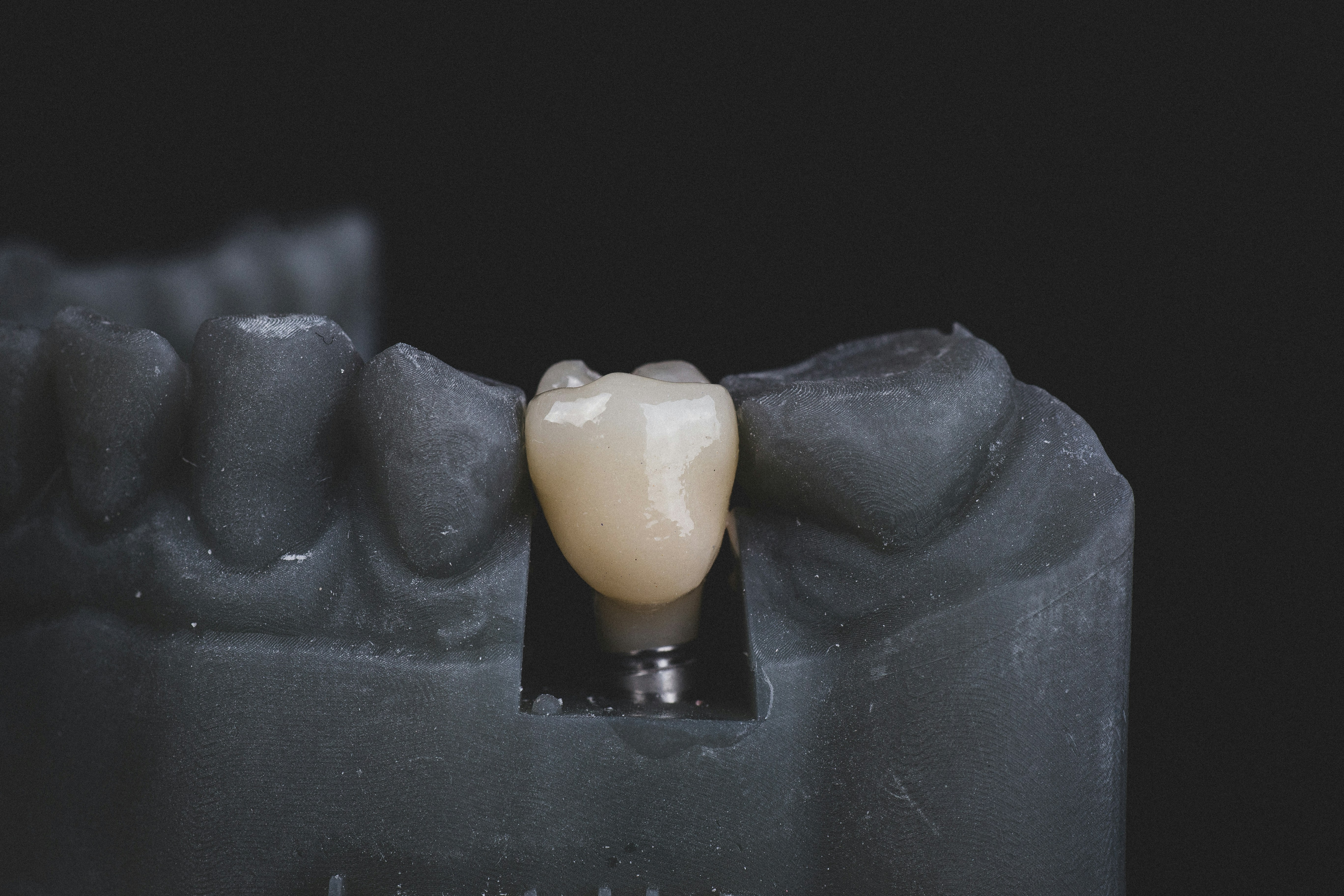 Dental implants round thumbnail